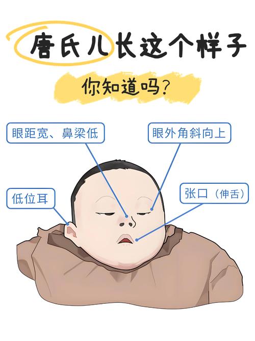 高層次看得出唐氏症嗎