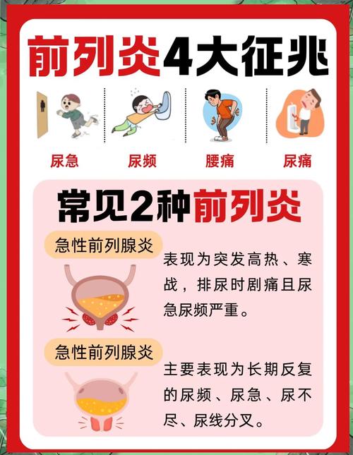 前列腺炎有什麼症狀