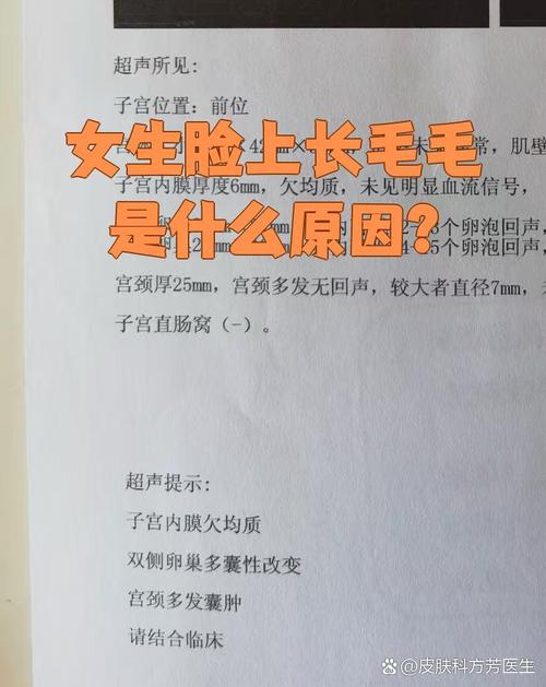 為什麼臉上會長毛