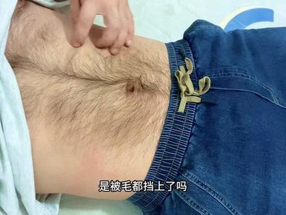 為什麼肚子會長毛?深入解析腹部毛髮的成因與相關知識 3 為什麼肚子會長毛