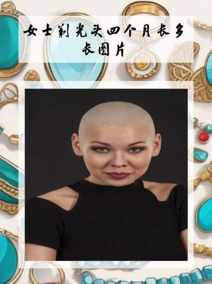 剃光頭多久長回來