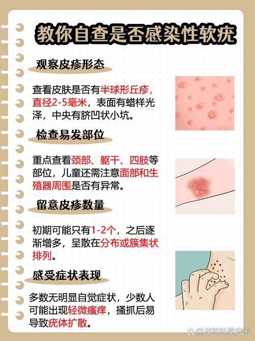 一定需要防毒軟體嗎?你的電腦真的安全嗎?深度解析電腦防護關鍵 1 一定要防毒軟體嗎