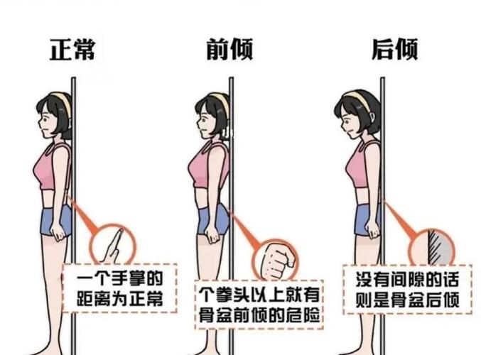 怎麼知道自己骨盆前傾?一篇搞懂居家自我檢測與改善方法 3 怎麼知道自己骨盆前傾