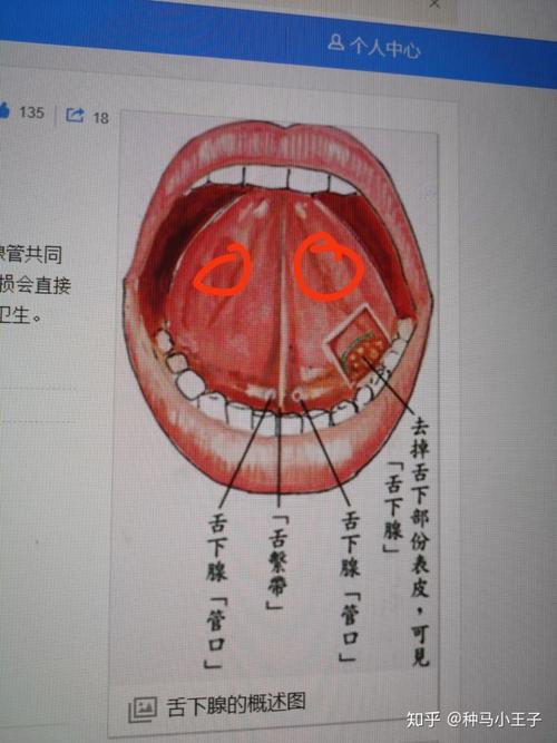 舌下腺在哪裡?深入解析唾液分泌的關鍵夥伴 1 舌下腺在哪裡