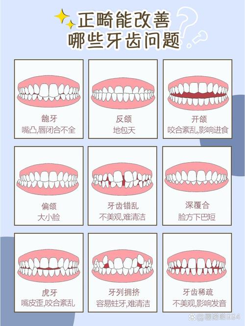 牙齒可數嗎?關於成人與兒童牙齒數量的詳盡解析 3 牙齒可數嗎