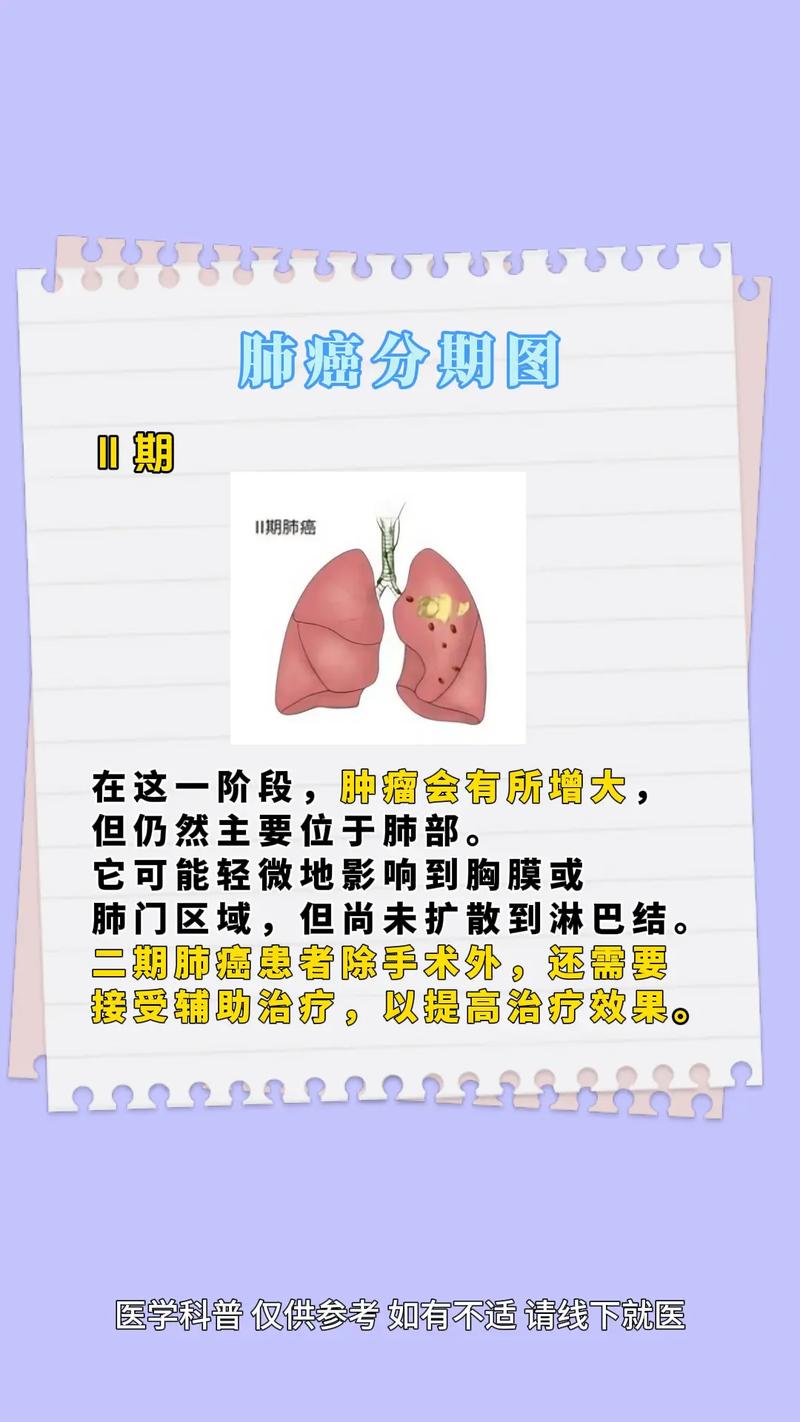 0期癌是什麼?掌握早期癌前病變的關鍵,為健康把關! 1 0期癌是什麼