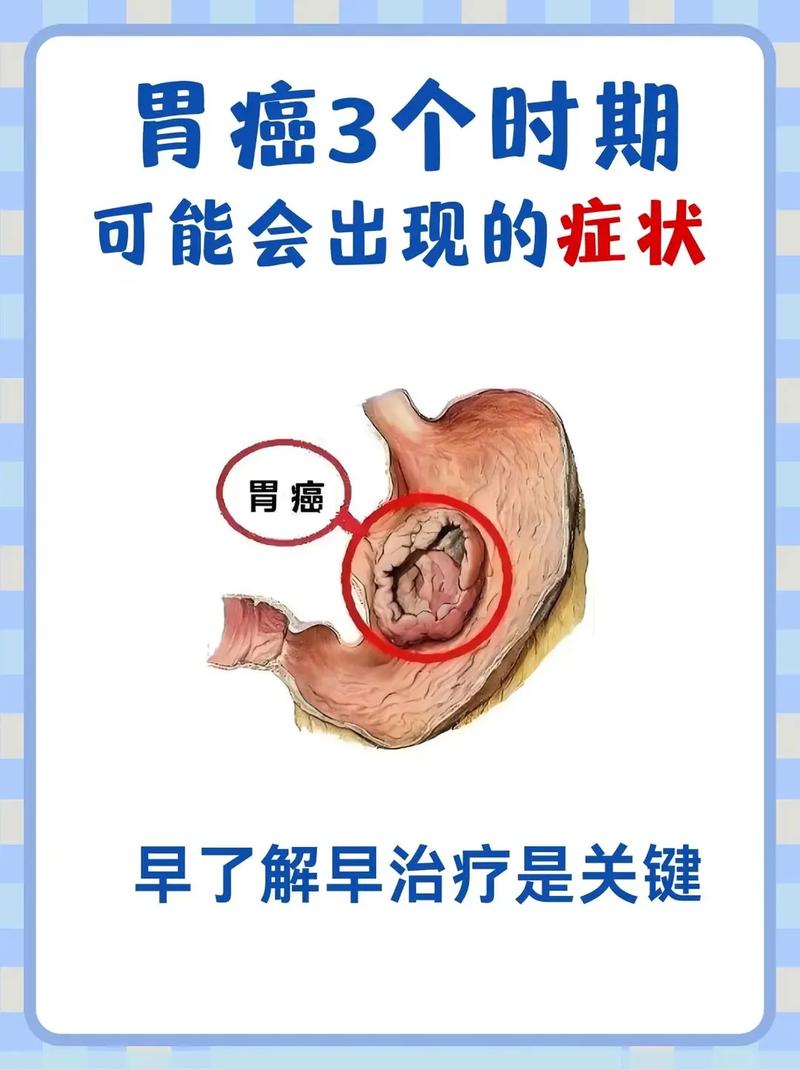 癌症會想吐嗎
