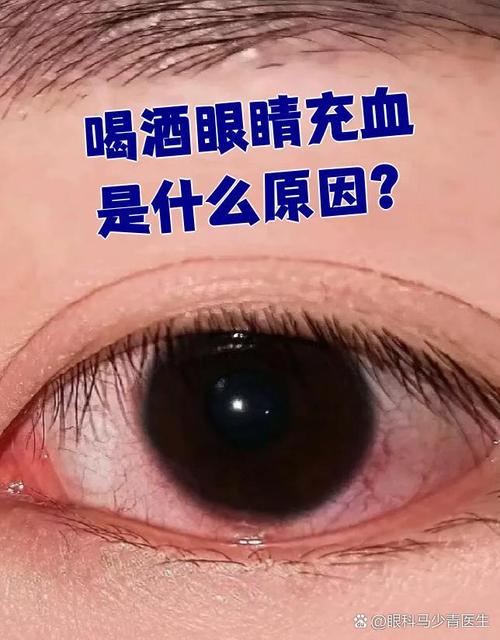 喝酒對眼睛有影響嗎