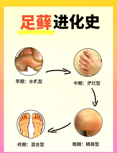 為什麼腳會酸酸的