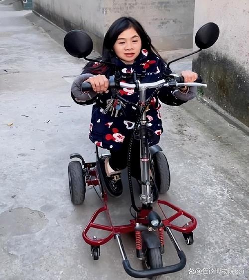 正常人會生出侏儒嗎?探討遺傳、環境與生育的複雜性 1 正常人會生出侏儒嗎