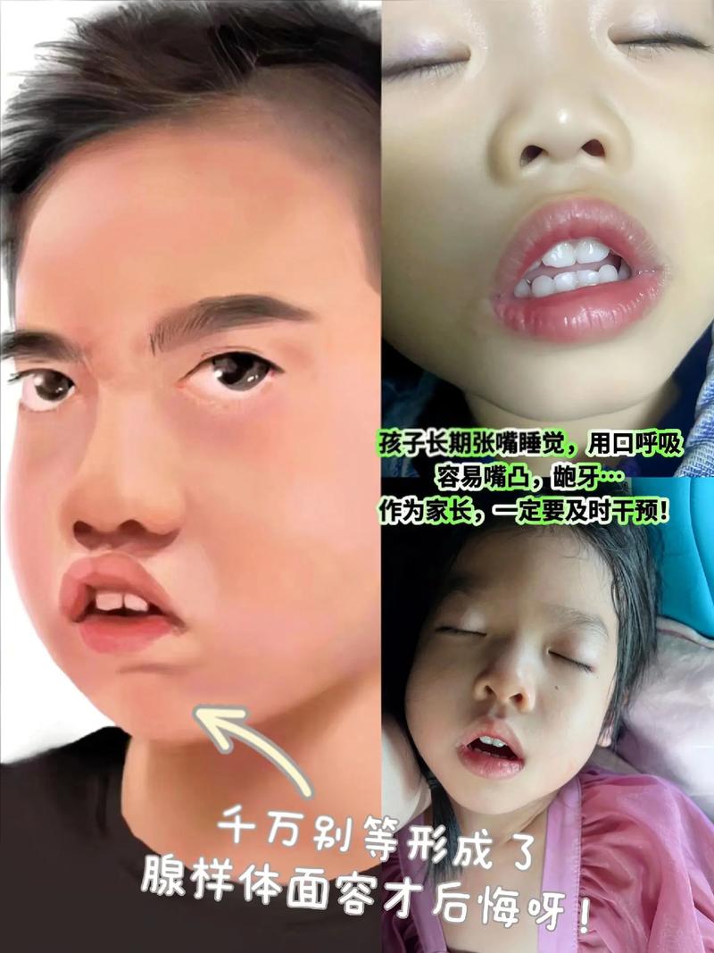 睡覺用嘴巴呼吸會脹氣嗎