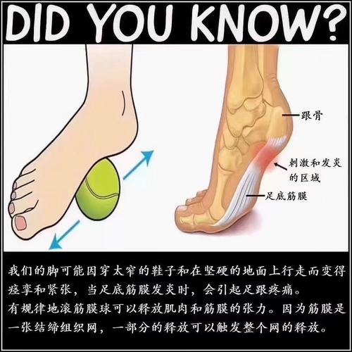 何謂腳底筋膜炎