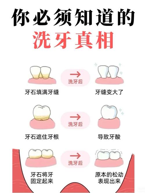 洗牙真的很痛嗎?深度解析,讓你不再害怕的洗牙全攻略 3 洗牙真的很痛嗎