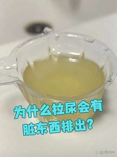 尿會髒嗎