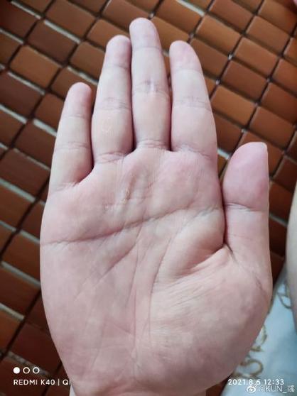 手紋淺