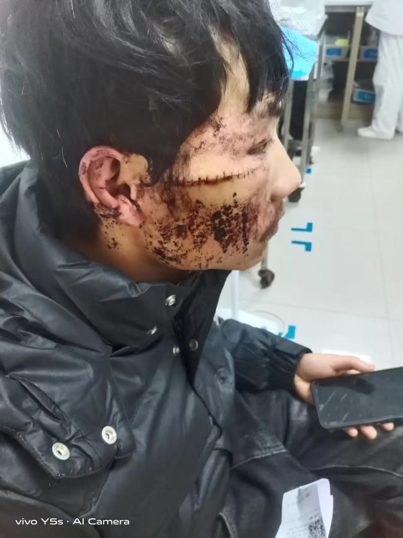 打頭是重傷害嗎?釐清觀念,解析頭部受擊對身體的影響 1 打頭是重傷害嗎
