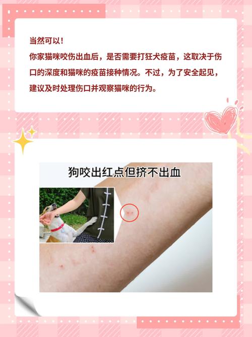 貓咬人要打針嗎