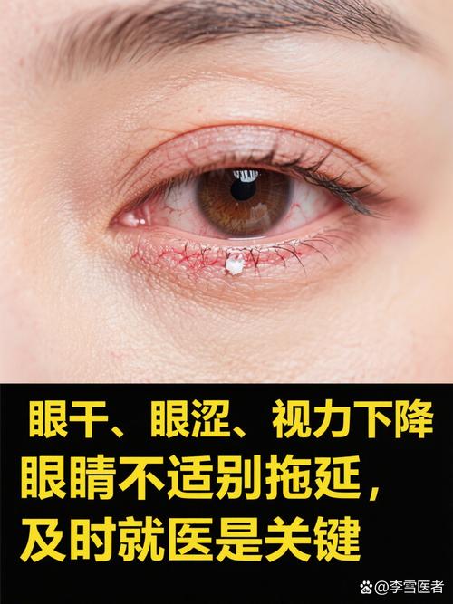 吃太辣會傷眼睛嗎
