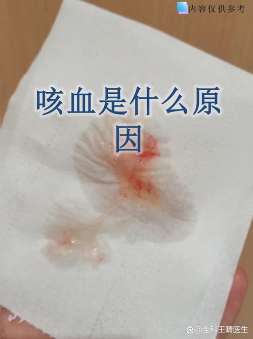 蘇丹紅會致死嗎