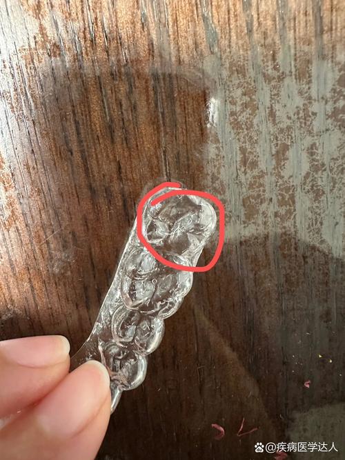 維持器不見怎麼辦