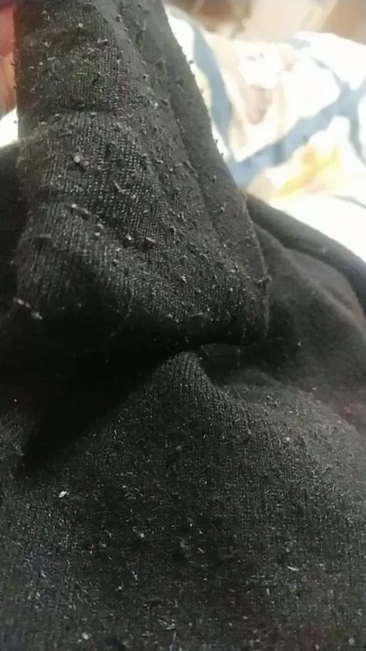 為什麼有些衣服會起毛球