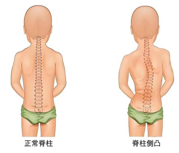 脊椎幾歲開始退化?別輕忽!認識黃金保養期與延緩退化秘訣 1 脊椎幾歲開始退化