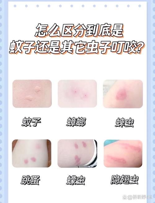 蚊子吸血後躲哪