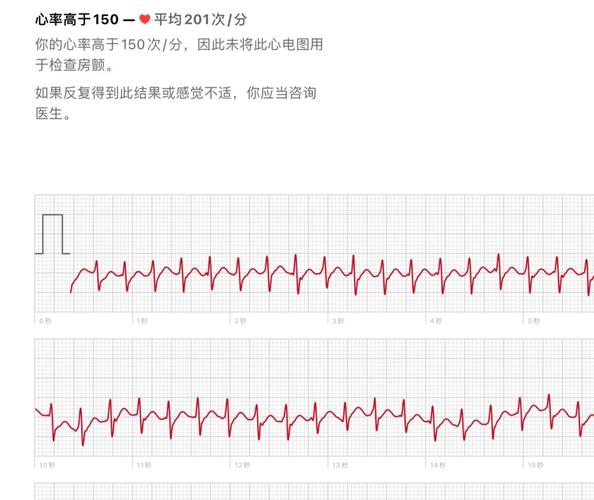 心跳幾下是正常
