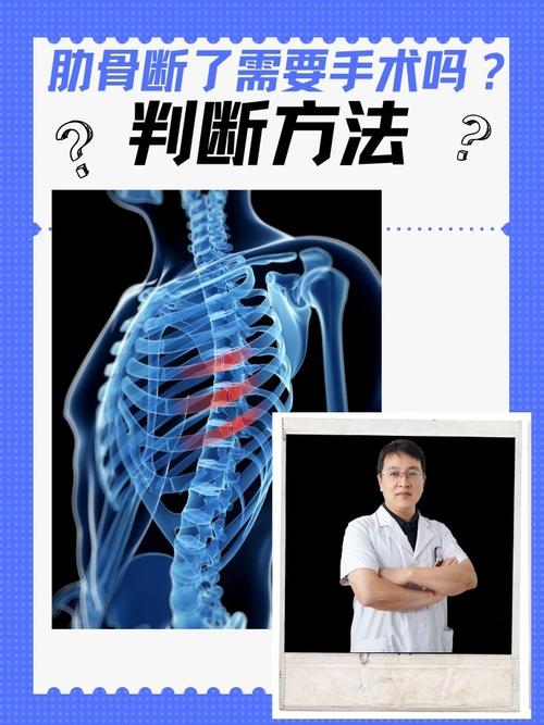 CPR一定會把肋骨壓斷嗎