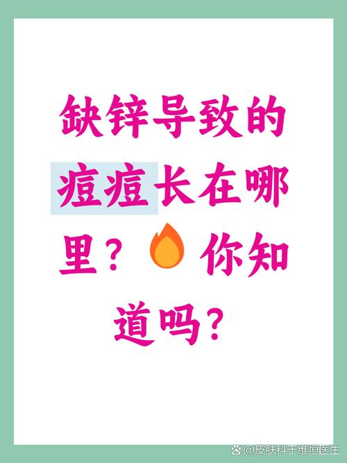 鋅對皮膚好嗎?揭秘礦物質鋅對肌膚的驚人益處與實用指南 1 鋅對皮膚好嗎