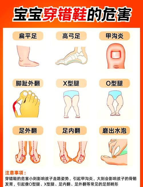 鞋子不防滑怎麼辦