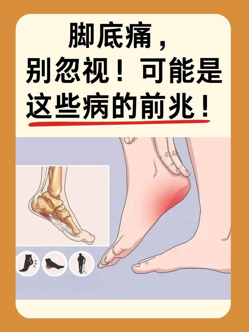 為什麼腳底板會抽筋?深入解析原因、預防與舒緩之道 1 為什麼腳底板會抽筋