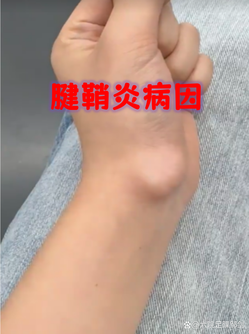 肌腱會變粗嗎