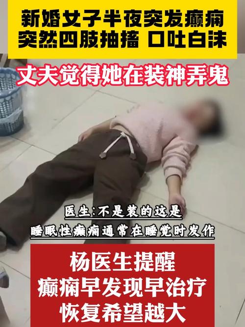 癲癇會口吐白沫嗎