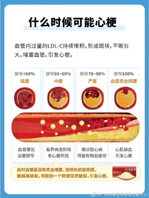 血管阻塞看哪一科