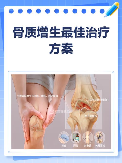 骨刺是如何形成的?一篇深度解析與日常預防指南 3 骨刺如何形成