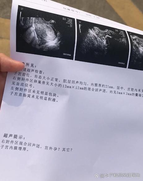 懷孕4週有感覺嗎?初期症狀、身體變化與妳的身體正在說什麼 3 懷孕4週有感覺嗎