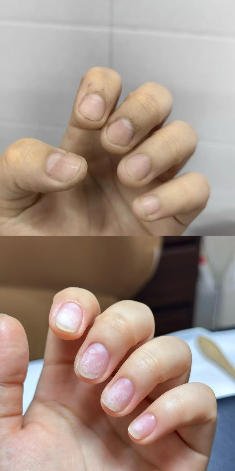 怎麼養甲床?全方位指南:告別脆弱,迎接健康強韌的指甲基底 3 怎麼養甲床
