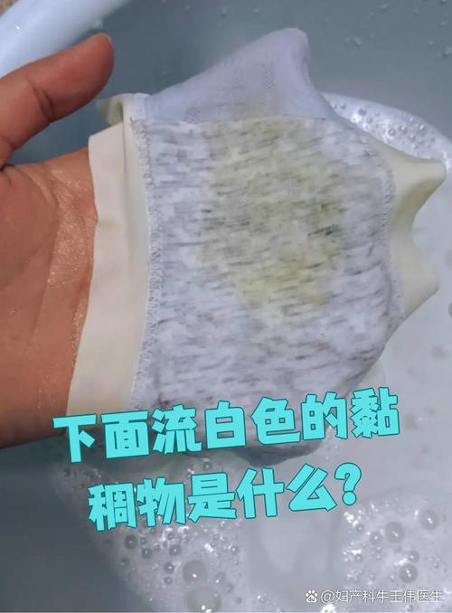 私密處有白白的