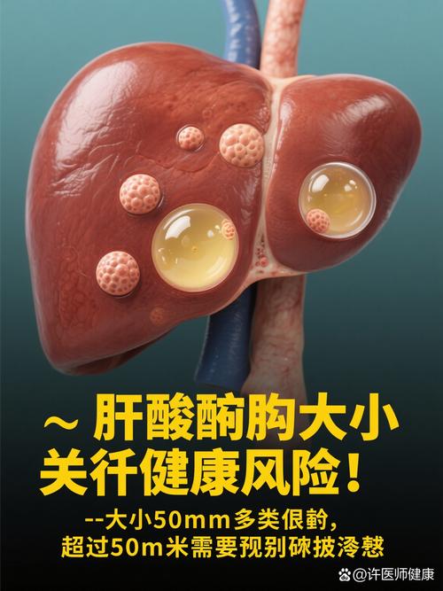 什麼是肝囊腫