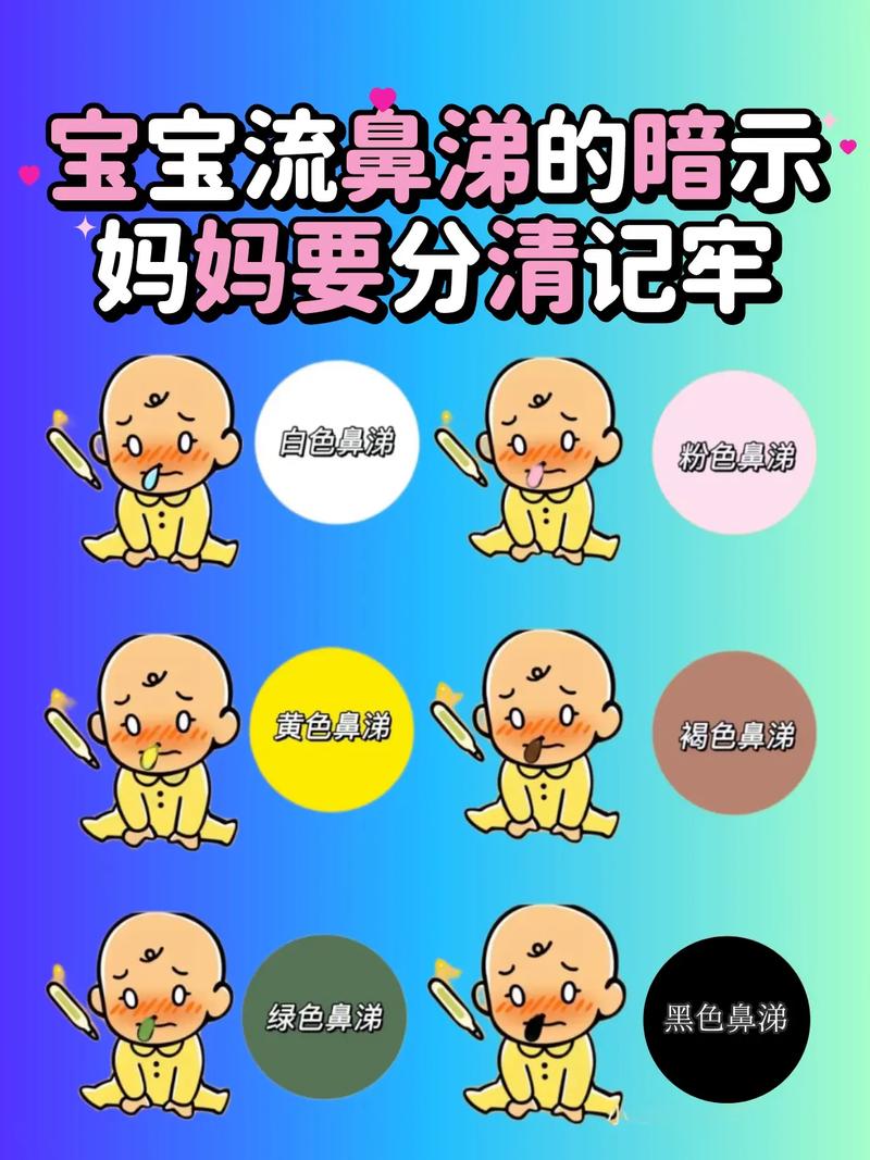 新生兒黃鼻涕怎麼辦