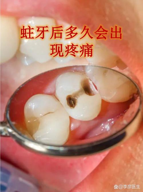 醋會腐蝕牙齒嗎?深度解析,保護你笑容的關鍵 1 醋會腐蝕牙齒嗎