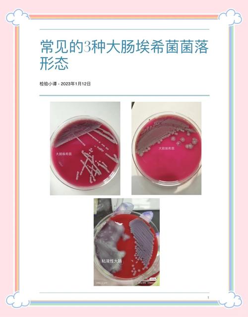大腸桿菌有質體嗎
