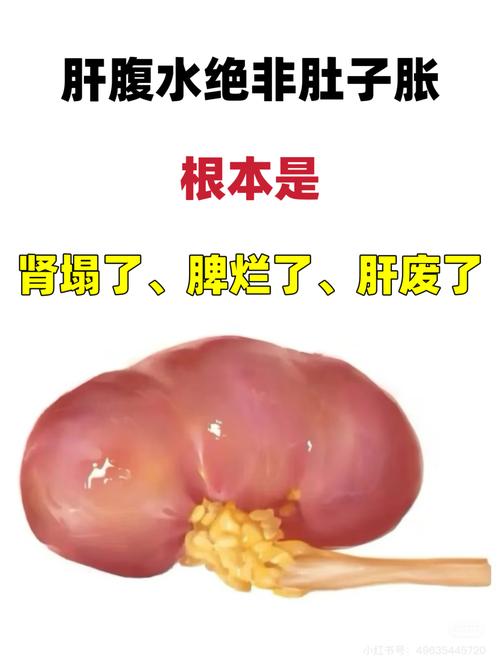 什麼是肝腹水