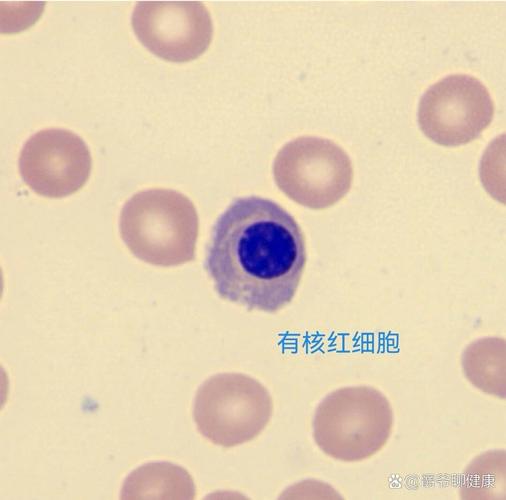 雞的紅血球有細胞核嗎