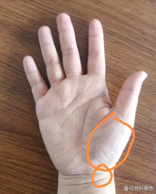 大拇指下面那塊肉叫什麼