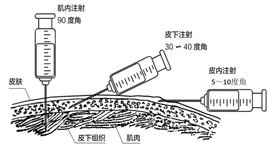 為什麼打針不能打動脈