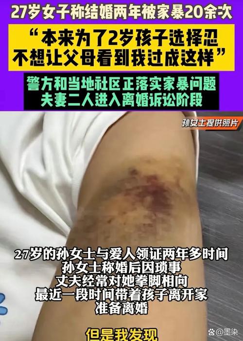 家暴可以告傷害嗎