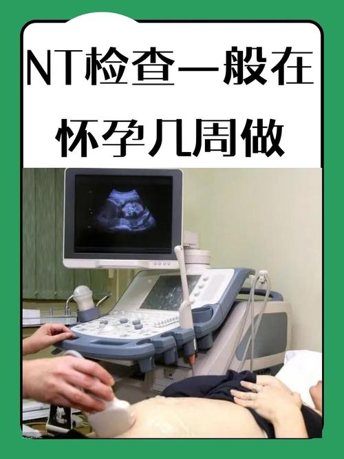 產檢可以錄影嗎