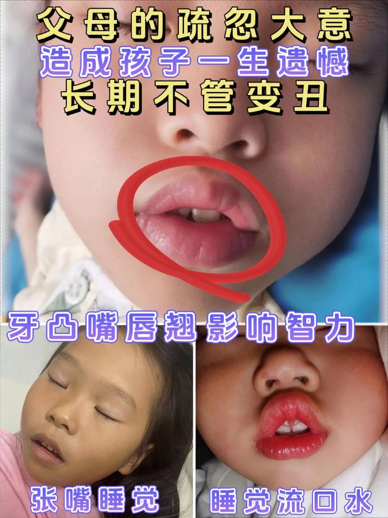 吃奶嘴嘴巴會變形嗎?了解常見迷思與牙齒發展影響 1 吃奶嘴嘴巴會變形嗎
